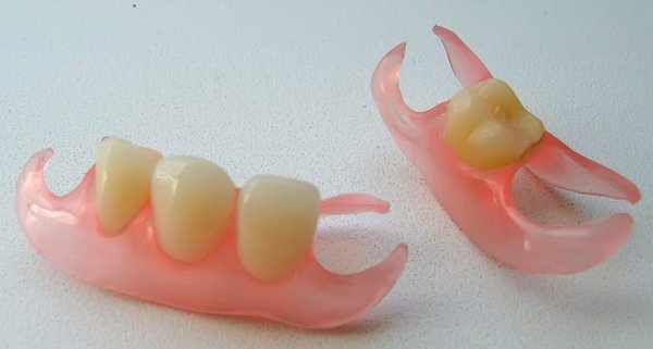 Зубной протез «бабочка»