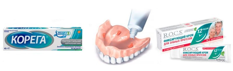 Крем для фиксации зубных протезов