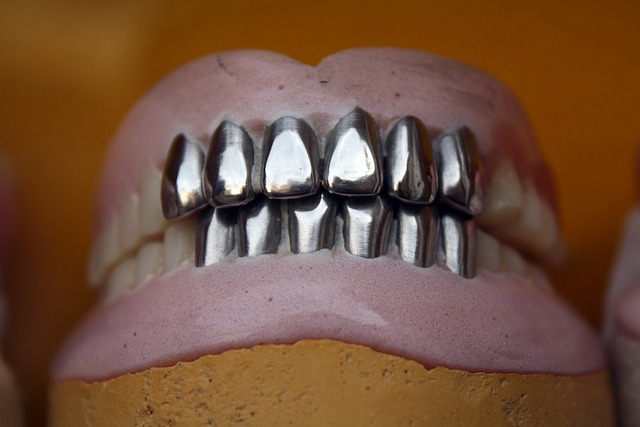 Неправильно изготовленный протез - одна из причин болей в зубе при жевании