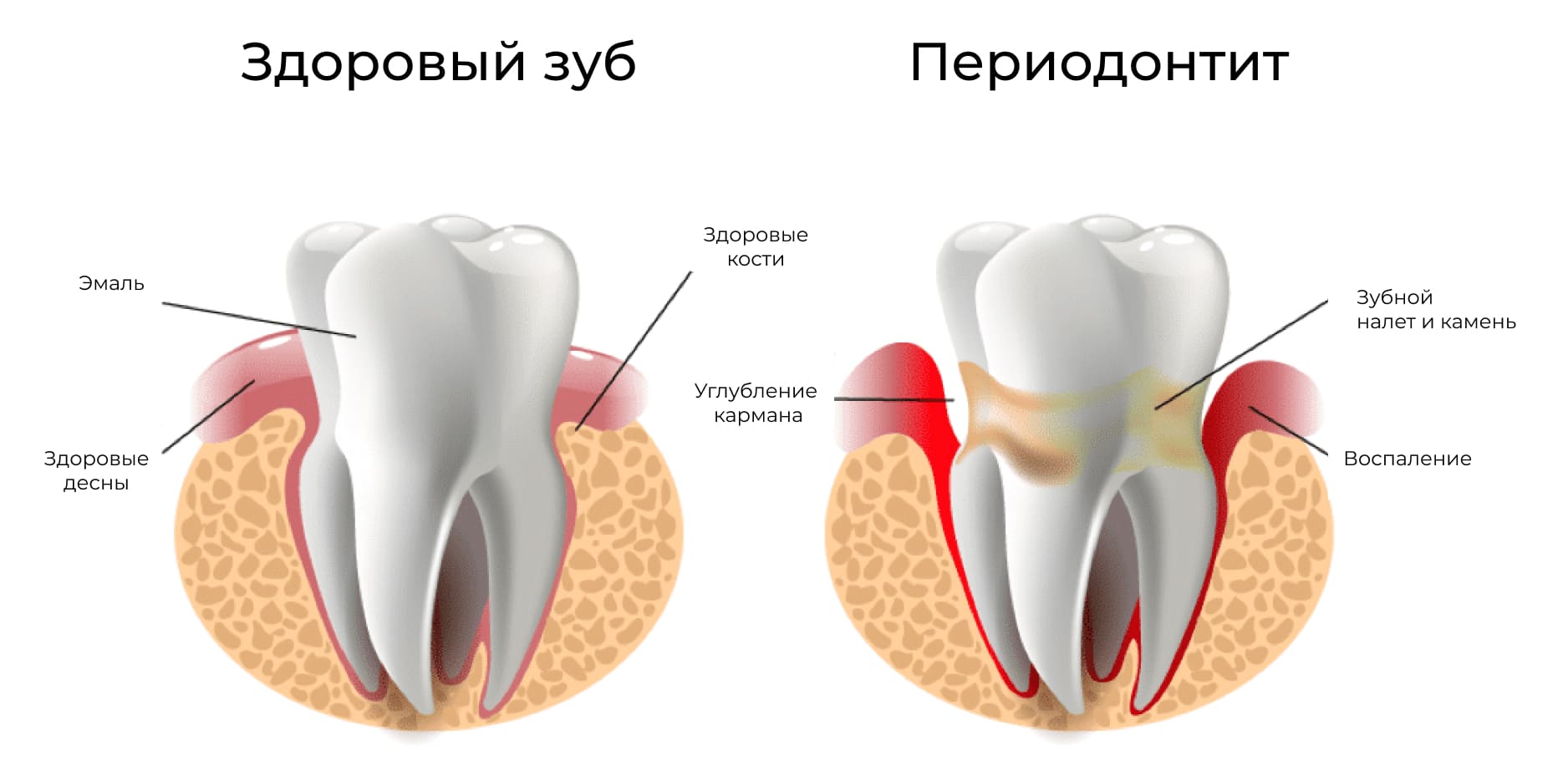 Строение периодонта