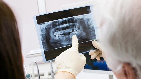 Рентгенография перед удалением корня зуба