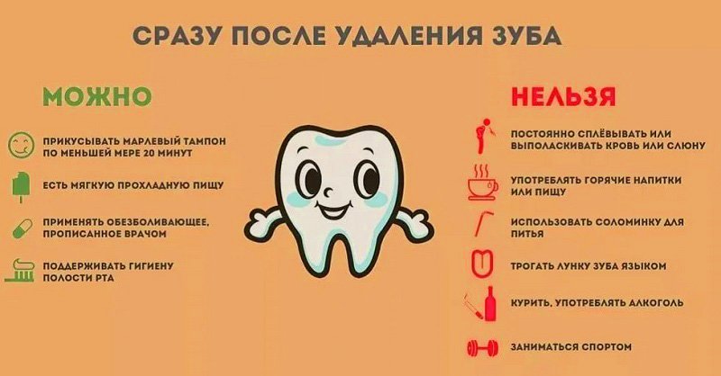 Что делать, чтобы не болел зуб после удаления
